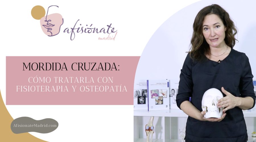 mordida cruzada osteopatia